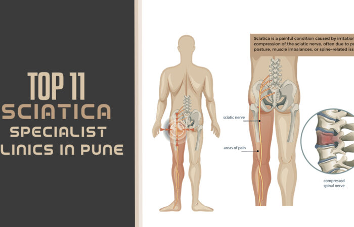 List of Top 11 Sciatica Specialist Clinics in Pune